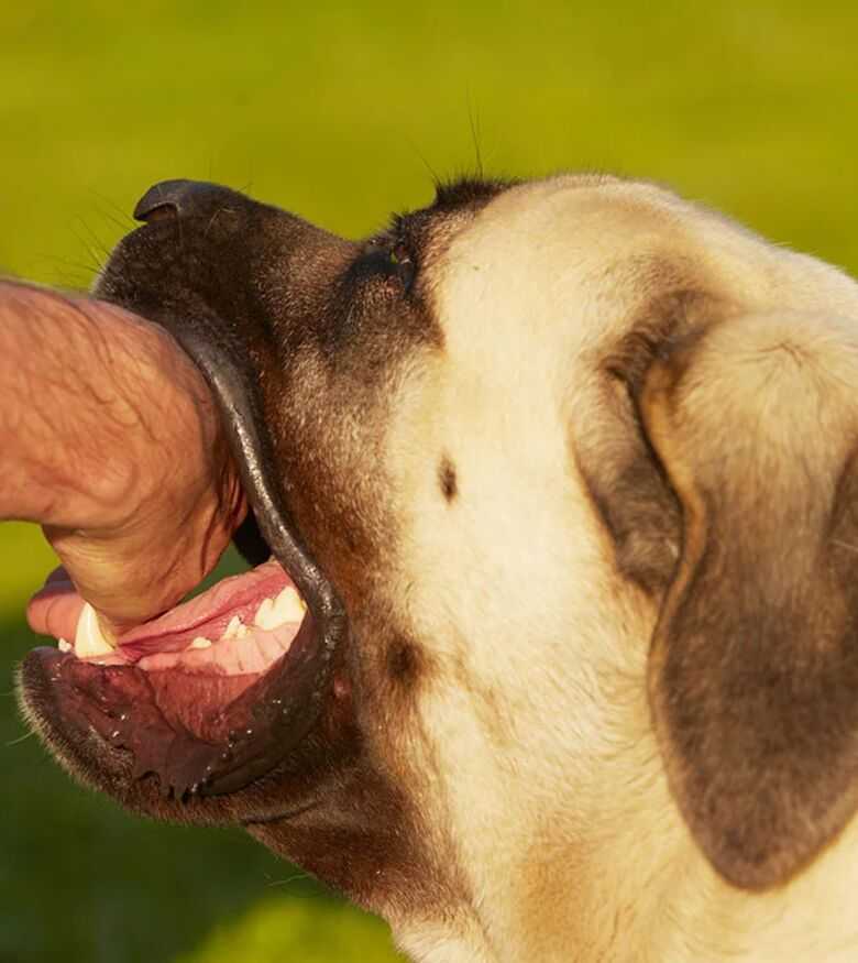 Lexington Dog Bite Attorneys - dog biting human hand
