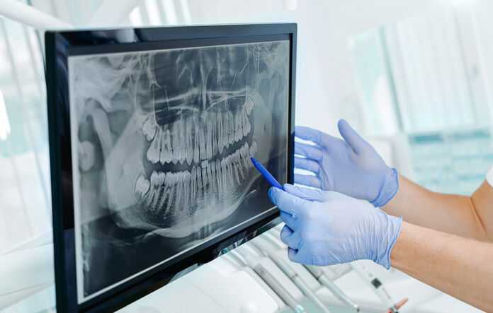 Florida Dental Malpractice - Dentist