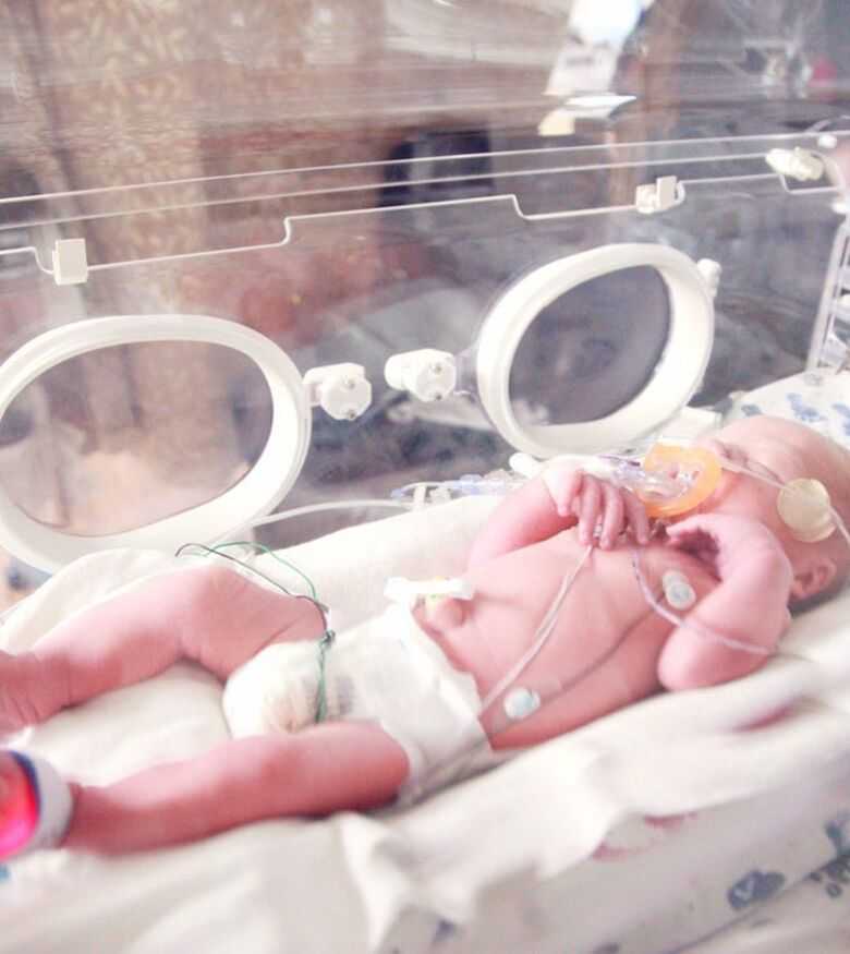 Best Birth Injury Lawyer in Covington, KY - newborn baby in nicu
