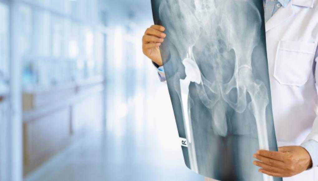 Stryker Agrees to Settle Hip Implant Cases for $1 Billion - Hip Scan