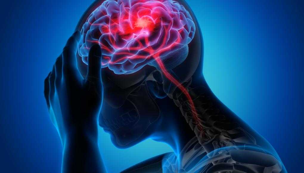 Everything You Need to Know About Head Injuries From Car Accidents