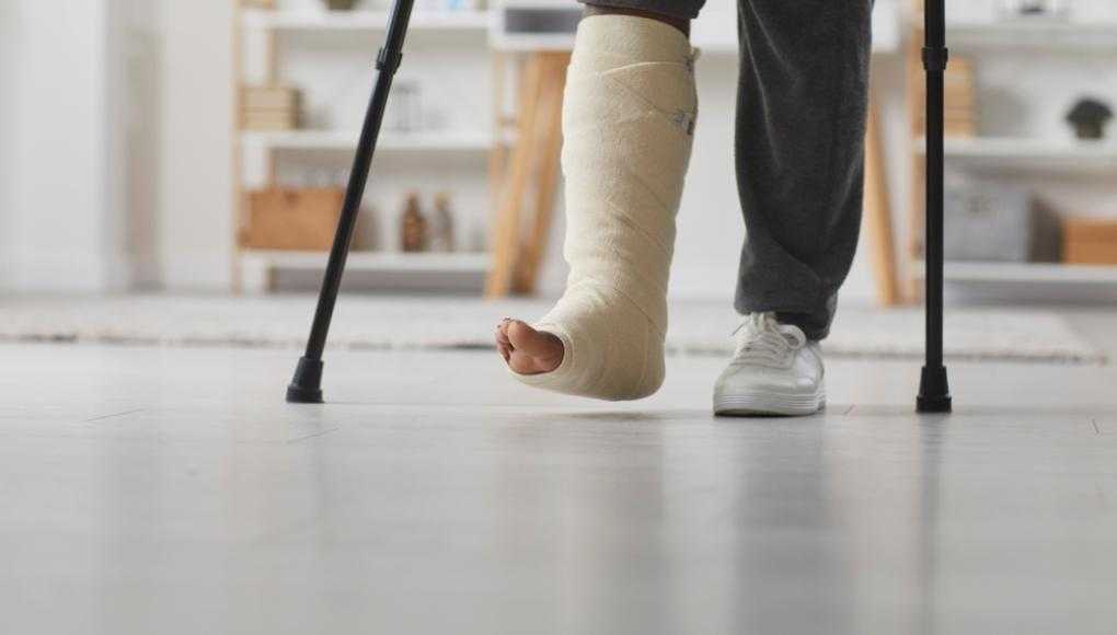 Girl in a leg cast walking with crutches