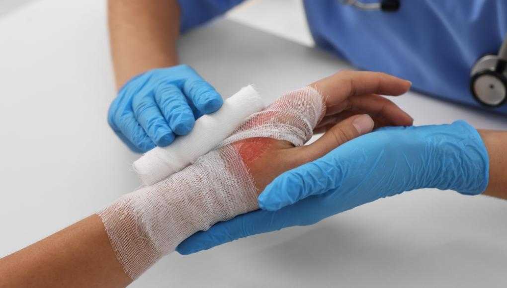 Doctor bandaging patient with a burned hand