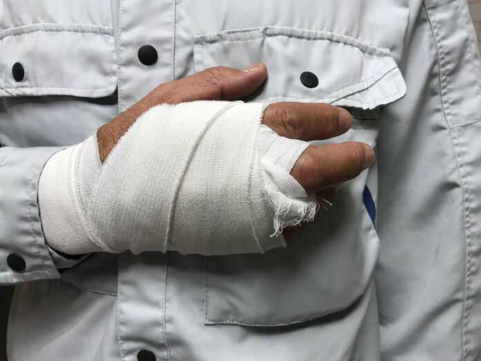 Workers’ Compensation Lawyers in Sarasota, Florida (FL) - Man with injured hand