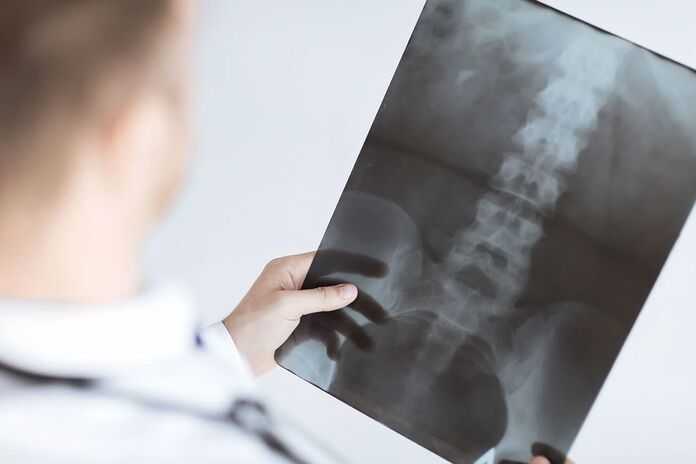 Nashville Spinal Cord Injury Attorneys - spinal cord scan