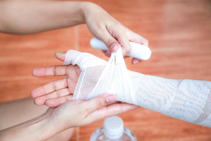 Where Can I Find the Best Burn Injury Lawyer in Indianapolis - hand with cast
