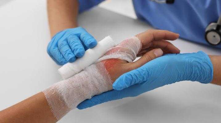 Doctor bandaging patient with a burned hand