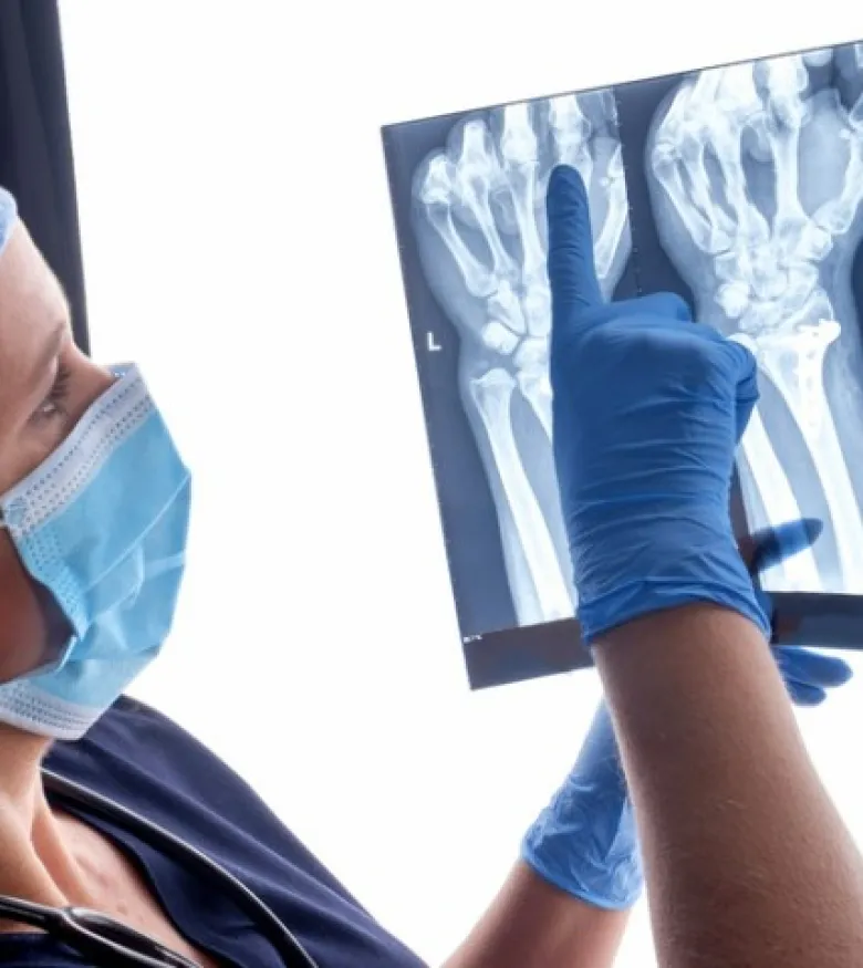 Is Hiring a Broken Bones Lawyer Important in Chicago - Doctor reviewing xray of broken bone