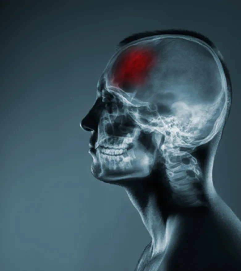 Brain Injury Attorney in Phoenix