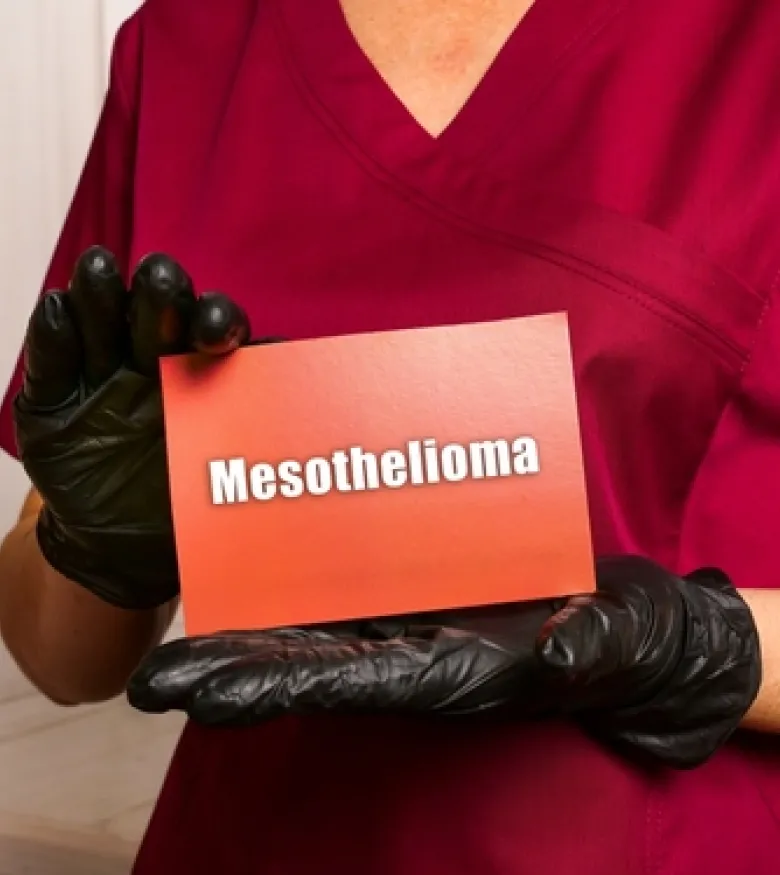 Mesothelioma Attorney in Las Vegas