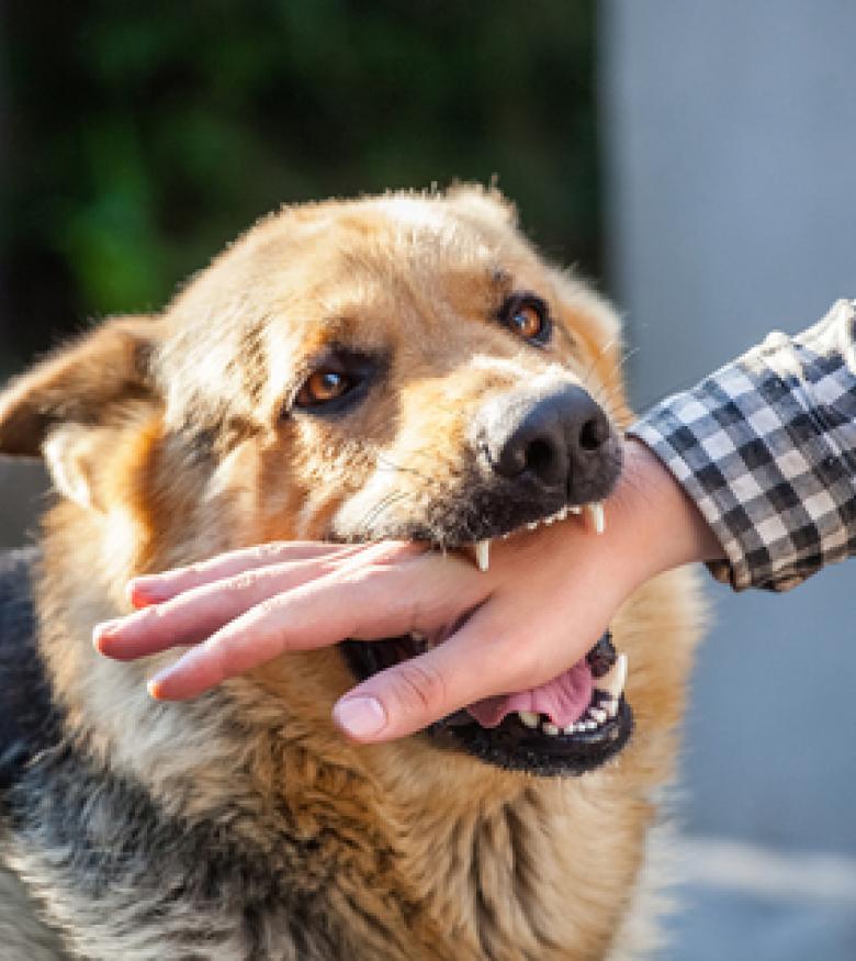 Aggressive dog biting a person's hand, highlighting the need for a Dog Bite Attorney in Charlotte.