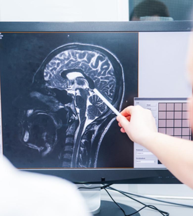 Doctors examining a brain scan on a computer screen, highlighting the need for a Brain Injury Attorney in New Albany to provide legal assistance.
