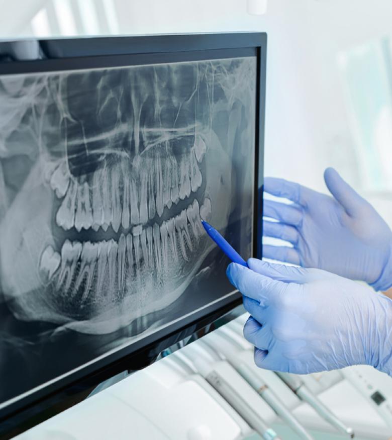 Georgia Dental Malpractice - Dentist